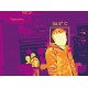 Thermographic Cameras Fever Screening - Fever Detection Thermographic Cameras Fever Screening - Fever Detection